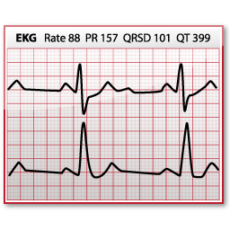 EKG
